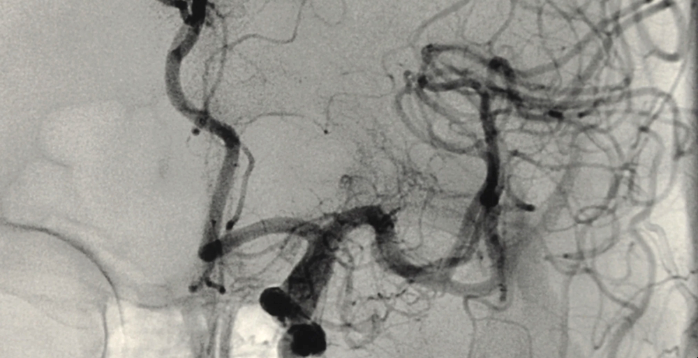 arteriography.jpg